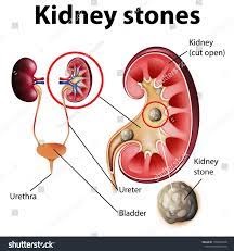 Picture credit: Shutterstock